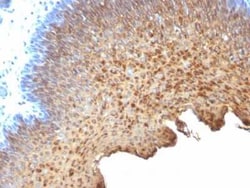 Cytokeratin 10/13 Antibody (SPM262), Novus Biologicals 0.1mg; Unlabeled:Antibodies,