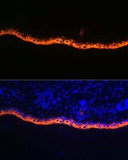Cytokeratin 10 Rabbit anti-Human, Mouse, Rat, Clone: 4S5Y7, Novus Biologicals