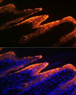 Cytokeratin 10 Rabbit anti-Human, Mouse, Rat, Clone: 4S5Y7, Novus Biologicals