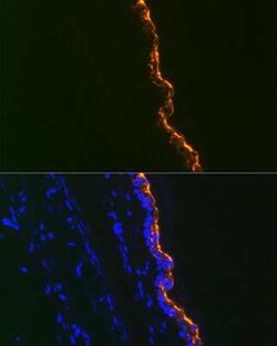 Cytokeratin 10 Rabbit anti-Human, Mouse, Rat, Clone: 4S5Y7, Novus Biologicals