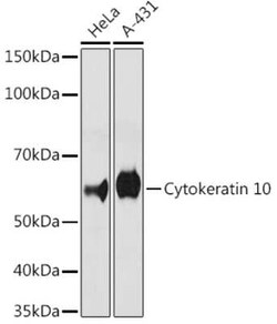 Cytokeratin 10 Rabbit anti-Human, Mouse, Rat, Clone: 4S5Y7, Novus Biologicals