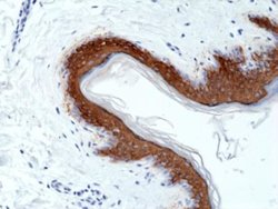 Cytokeratin 10 Antibody (RM386), Novus Biologicals 100 &mu;L; Unconjugated:Antibodies,