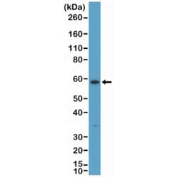 Cytokeratin 10 Antibody (RM386), Novus Biologicals 100 &mu;L; Unconjugated:Antibodies,
