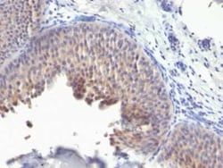 Cytokeratin 10 Antibody (KRT10/1275), Novus Biologicals:Antibodies:Primary