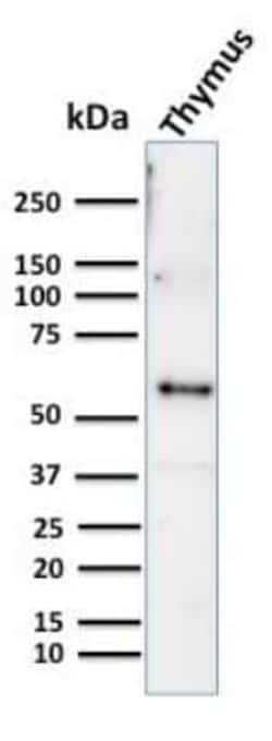Cytokeratin 10 Antibody (KRT10/844) - Azide and BSA Free, Novus Biologicals