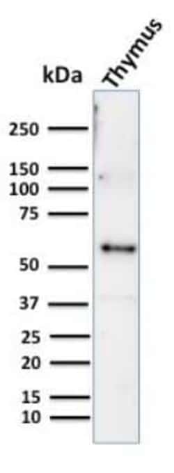 Cytokeratin 10 Antibody (KRT10/844), Novus Biologicals:Antibodies:Primary