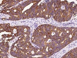 Cytokeratin 12 Antibody, Novus Biologicals 100 &mu;g | Buy Online | Novus Biologicals | Fisher Scientific