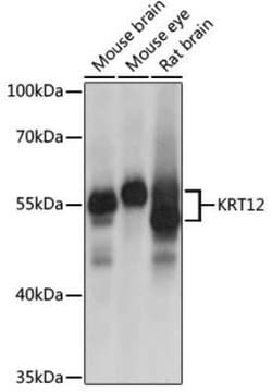 Cytokeratin 12 Antibody - Azide and BSA Free, Novus Biologicals 0.02 mL,
