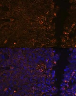 Cytokeratin 13 Rabbit anti-Human, Mouse, Rat, Clone: 5M6B10, Novus Biologicals