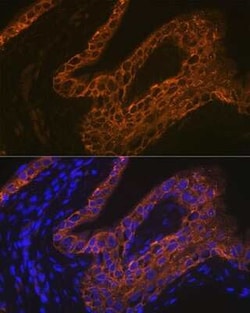 Cytokeratin 13 Rabbit anti-Human, Mouse, Rat, Clone: 5M6B10, Novus Biologicals