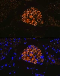 Cytokeratin 13 Rabbit anti-Human, Mouse, Rat, Clone: 5M6B10, Novus Biologicals