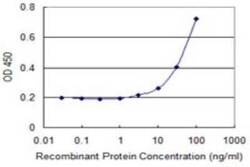 Cytokeratin 13 Antibody (4F5), Novus Biologicals 0.1 mg | Buy Online | Novus Biologicals | Fisher Scientific