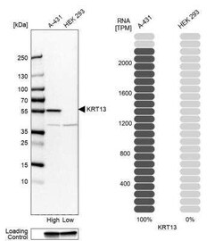 Cytokeratin 13 Antibody, Novus Biologicals 100 &mu;g; Unconjugated:Antibodies,