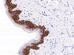 Cytokeratin 14 Rabbit anti-Human, Clone: 101, Novus Biologicals 50 &mu;g;