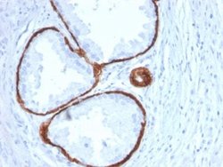 Cytokeratin 14 Mouse anti-Human, Mouse, Rat, Porcine, Clone: KRT14/2375,