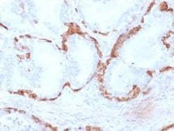 Cytokeratin 14 Mouse anti-Human, Mouse, Rat, Porcine, Clone: KRT14/2375,