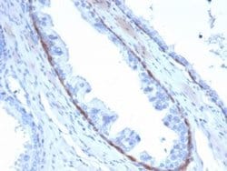Cytokeratin 14 Mouse anti-Human, Clone: KRT14/4132, Novus Biologicals 20