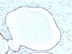 Cytokeratin 14 Antibody (KRT14/4132) - Azide and BSA Free, Novus Biologicals