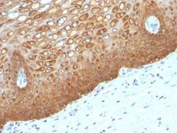 Cytokeratin 14 Antibody (KRT14/532), Novus Biologicals 0.1mg; Unlabeled:Antibodies,