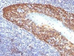 Cytokeratin 14 Antibody (KRT14/532), Novus Biologicals 0.1mg; Unlabeled:Antibodies,