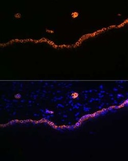 Cytokeratin 15 Rabbit anti-Human, Rat, Clone: 9F9F0, Novus Biologicals 20 &mu;g | Buy Online | Novus Biologicals | Fisher Scientific