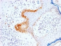 Cytokeratin 15 Antibody (KRT15/2103R) - Azide and BSA Free, Novus Biologicals 100 &mu;g | Buy Online | Novus Biologicals | Fisher Scientific
