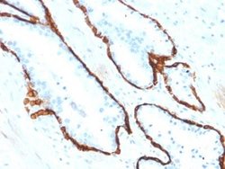 Cytokeratin 15 Mouse anti-Human, Clone: KRT15/2554, Novus Biologicals 20 &mu;g | Buy Online | Novus Biologicals | Fisher Scientific