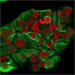 Cytokeratin 15 Antibody (KRT15/2957) - Azide and BSA Free, Novus Biologicals
