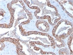 Cytokeratin 15 Mouse anti-Human, Clone: KRT15/2957, Novus Biologicals:Antibodies:Primary
