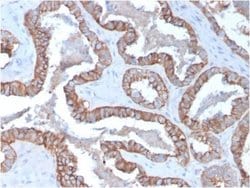 Cytokeratin 15 Antibody (KRT15/2957) - Azide and BSA Free, Novus Biologicals