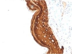 Cytokeratin 15 Antibody (KRT15/2957) - Azide and BSA Free, Novus Biologicals