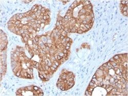 Cytokeratin 15 Antibody (KRT15/2957) - Azide and BSA Free, Novus Biologicals