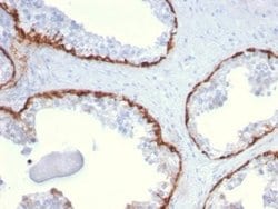 Cytokeratin 15 Mouse anti-Human, Clone: KRT15/2959, Novus Biologicals 100