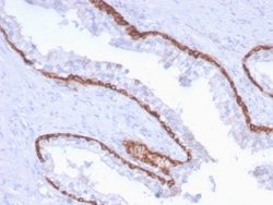 Cytokeratin 15 Mouse anti-Human, Clone: KRT15/2959, Novus Biologicals 100