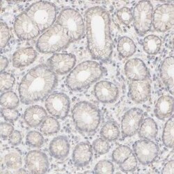 Cytokeratin 15 Antibody, Novus Biologicals 25 &mu;L; Unconjugated:Antibodies,