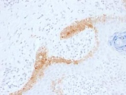 Cytokeratin 15 Antibody (KRT15/1699), Novus Biologicals 100&mu;g; Unlabeled:Antibodies,
