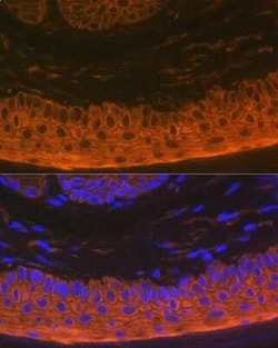 Cytokeratin 16 Rabbit anti-Human, Mouse, Rat, Clone: 8L6R4, Novus Biologicals