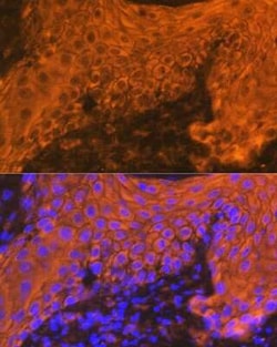 Cytokeratin 16 Rabbit anti-Human, Mouse, Rat, Clone: 8L6R4, Novus Biologicals