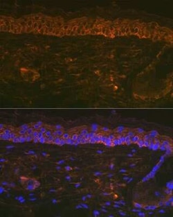 Cytokeratin 16 Rabbit anti-Human, Mouse, Rat, Clone: 8L6R4, Novus Biologicals