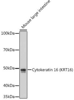 Cytokeratin 16 Rabbit anti-Human, Mouse, Rat, Clone: 8L6R4, Novus Biologicals