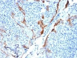 Cytokeratin 16 Mouse anti-Human, Clone: KRT16/1714, Novus Biologicals:Antibodies:Primary