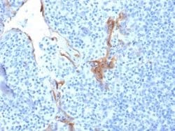 Cytokeratin 16 Mouse anti-Human, Clone: LL025, Novus Biologicals 20 &mu;g;