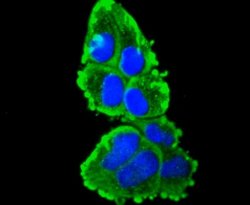 Cytokeratin16 Rabbit anti-Human, Clone: SC52-09, Novus Biologicals 100&mu;L:Antibodies,