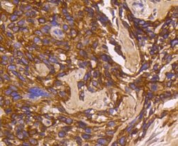 Cytokeratin16 Rabbit anti-Human, Clone: SC52-09, Novus Biologicals 100&mu;L:Antibodies,