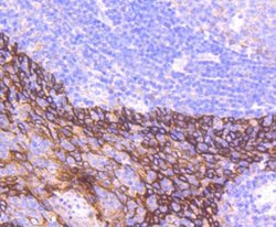 Cytokeratin16 Rabbit anti-Human, Clone: SC52-09, Novus Biologicals 100&mu;L:Antibodies,