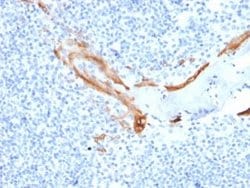 Cytokeratin 16 Mouse anti-Human, Clone: SPM264, Novus Biologicals:Antibodies:Primary