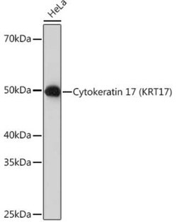 Cytokeratin 17 Rabbit anti-Human, Clone: 9O6X9, Novus Biologicals 100 &mu;g;