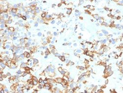 Cytokeratin 17 Antibody (KRT17/4604) - Azide and BSA Free, Novus Biologicals 100 &mu;g | Buy Online | Novus Biologicals | Fisher Scientific