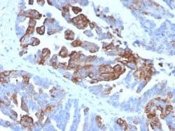 Cytokeratin 17 Mouse anti-Human, Clone: KRT17/4604, Novus Biologicals 100