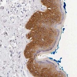 Cytokeratin 17 Antibody, Novus Biologicals 0.1 mL; Unconjugated:Antibodies,
